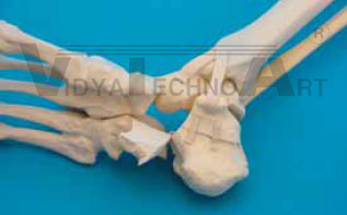 Foot 4-part, fractured